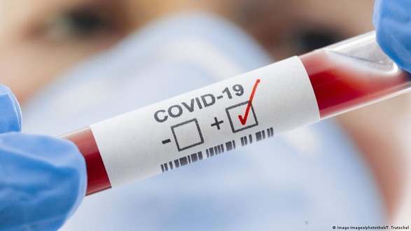 В Украине не исключают возврата ограничений при росте заболеваемости на COVID-19